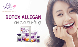 Trị cười hở lợi bằng botox